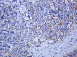 KRT5 / CK5 / Cytokeratin 5 Antibody (aa1-273, clone OTI1E7)