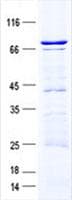 Human Translokin / CEP57 Protein (Recombinant GST, N-terminus + His, C-terminus)