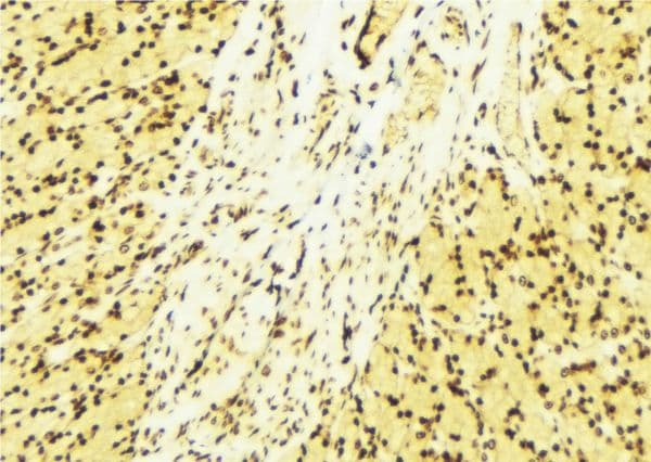 RORA / ROR Alpha Antibody
