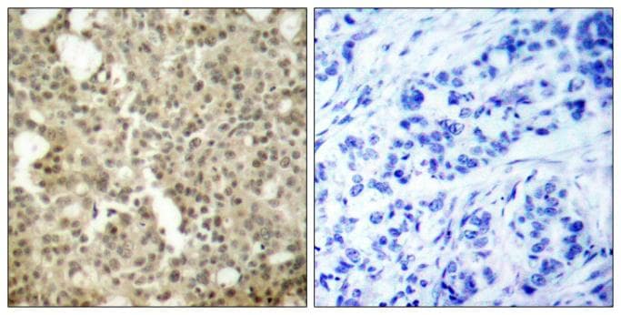 Polyclonal Rabbit anti-Human PRKCD / PKC-Delta Antibody (p645, IHC, WB)
