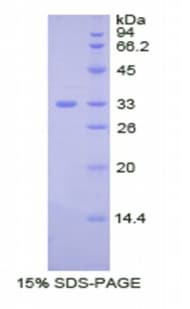 Human CP / Ceruloplasmin Protein (Recombinant His)