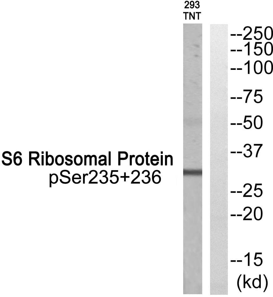 Polyclonal Rabbit anti-Human RPS6 / Ribosomal Protein S6 Antibody (phospho-Ser235+Ser236, IHC, WB)
