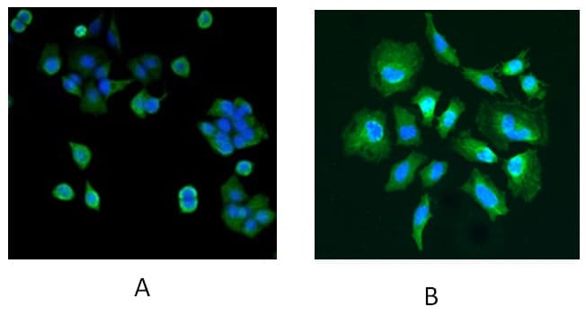 IHC-plus™ PARK7 / DJ-1 Antibody (aa178-189)