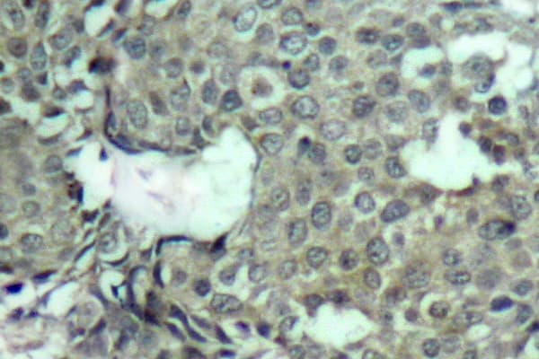 MEK1 + MEK2 Antibody (phospho-Ser222)