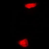 Polyclonal Rabbit anti-Human PHYHD1 Antibody (IF, WB)