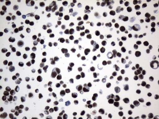 FOXP1 Antibody (clone UMAB242)