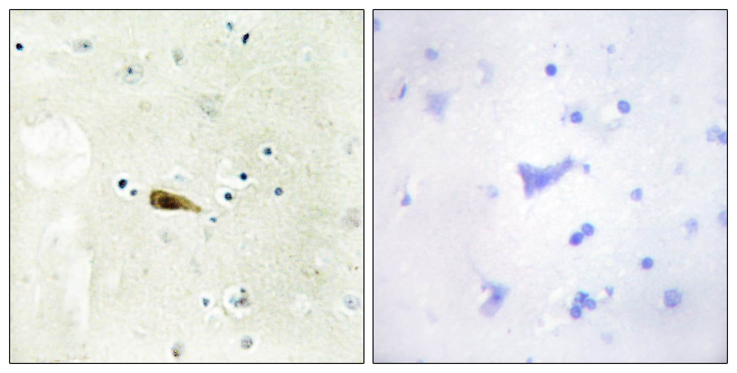MYST1 Antibody (aa101-150)