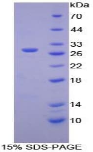 Mouse HEXA Protein (Recombinant His-T7)