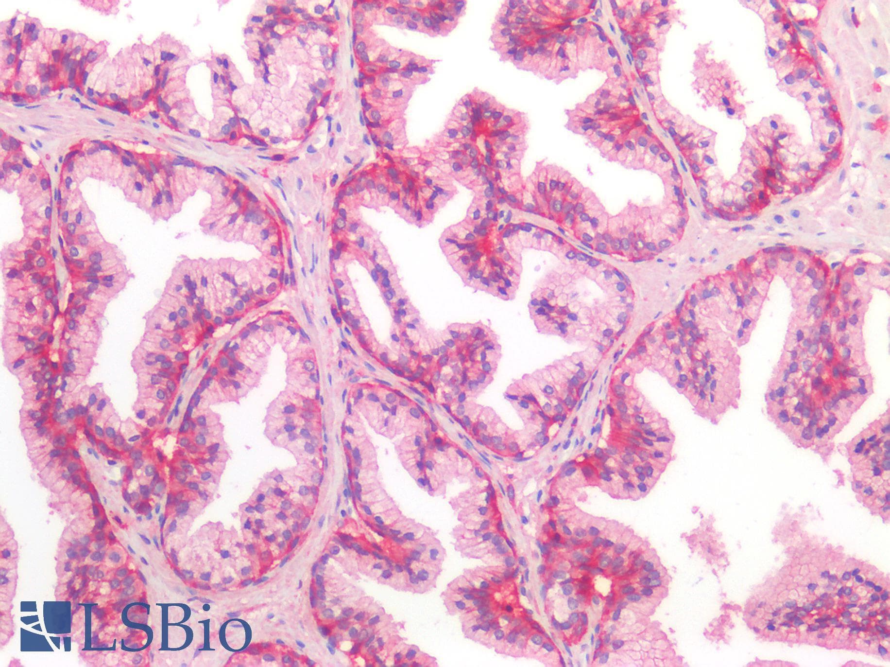 PathPlus™ CD44 Antibody (clone 8E2F3)