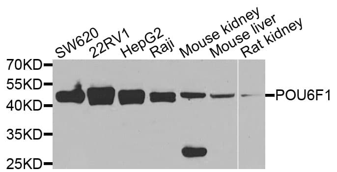 Polyclonal Rabbit anti-Human POU6F1 / BRN5 Antibody (IHC, IF, WB)