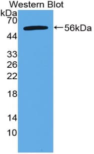 AATF Antibody (aa273-477)