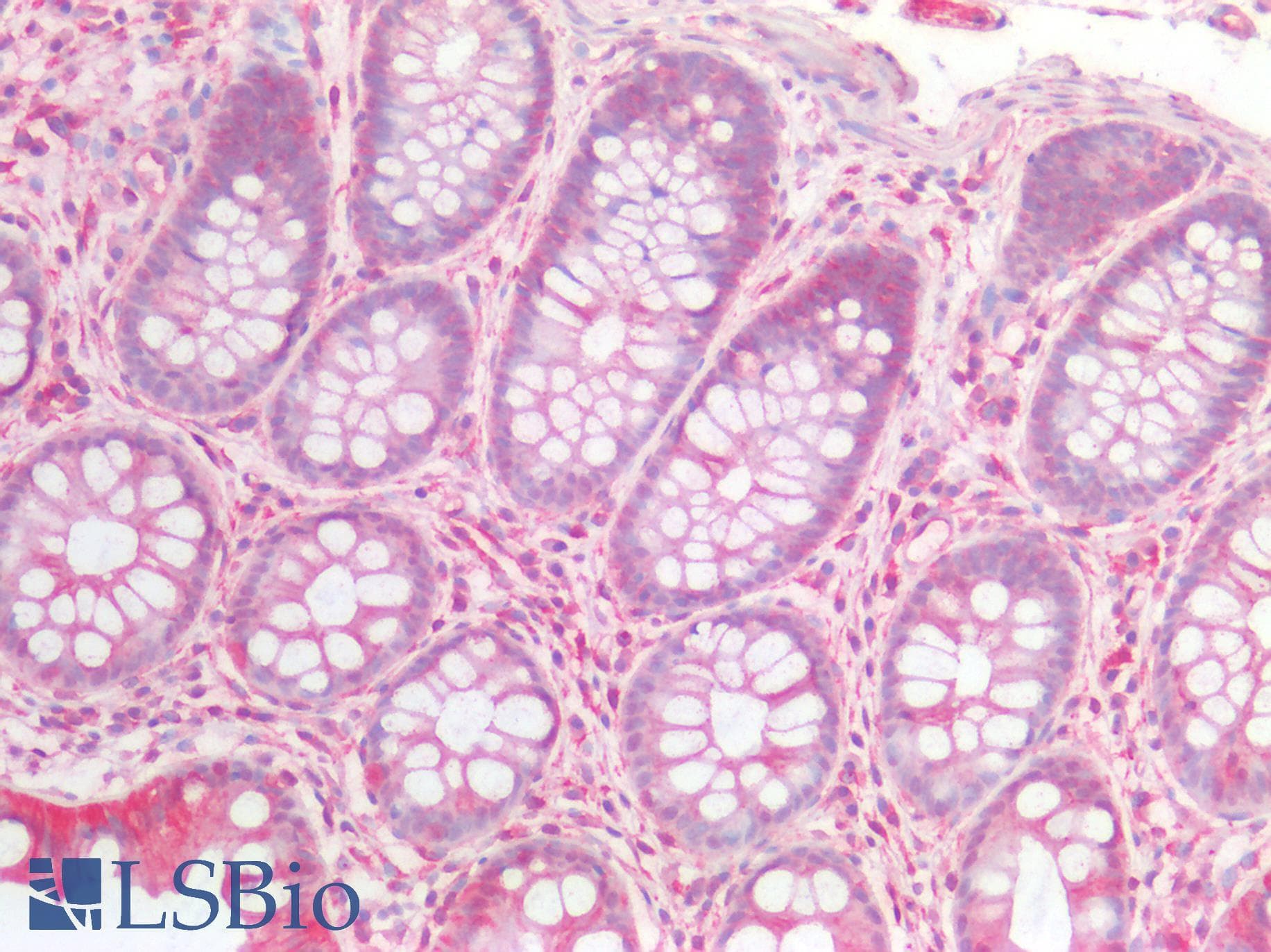 IHC-plus™ NTN1 / Netrin 1 Antibody