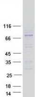 Human ADAM11 Protein (Recombinant Myc-DDK (Flag))