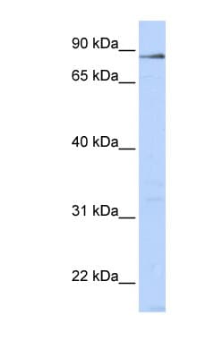 Polyclonal Rabbit anti-Human L3MBTL4 Antibody (aa36-85, WB)