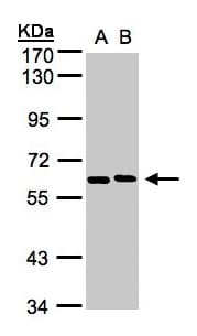 NT5C2 Antibody (aa108-362)