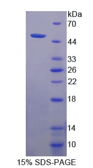 Human PLB1 Protein (Recombinant His-T7)