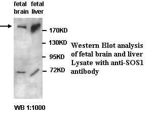 Polyclonal Rabbit anti-Human SOS1 Antibody (WB)