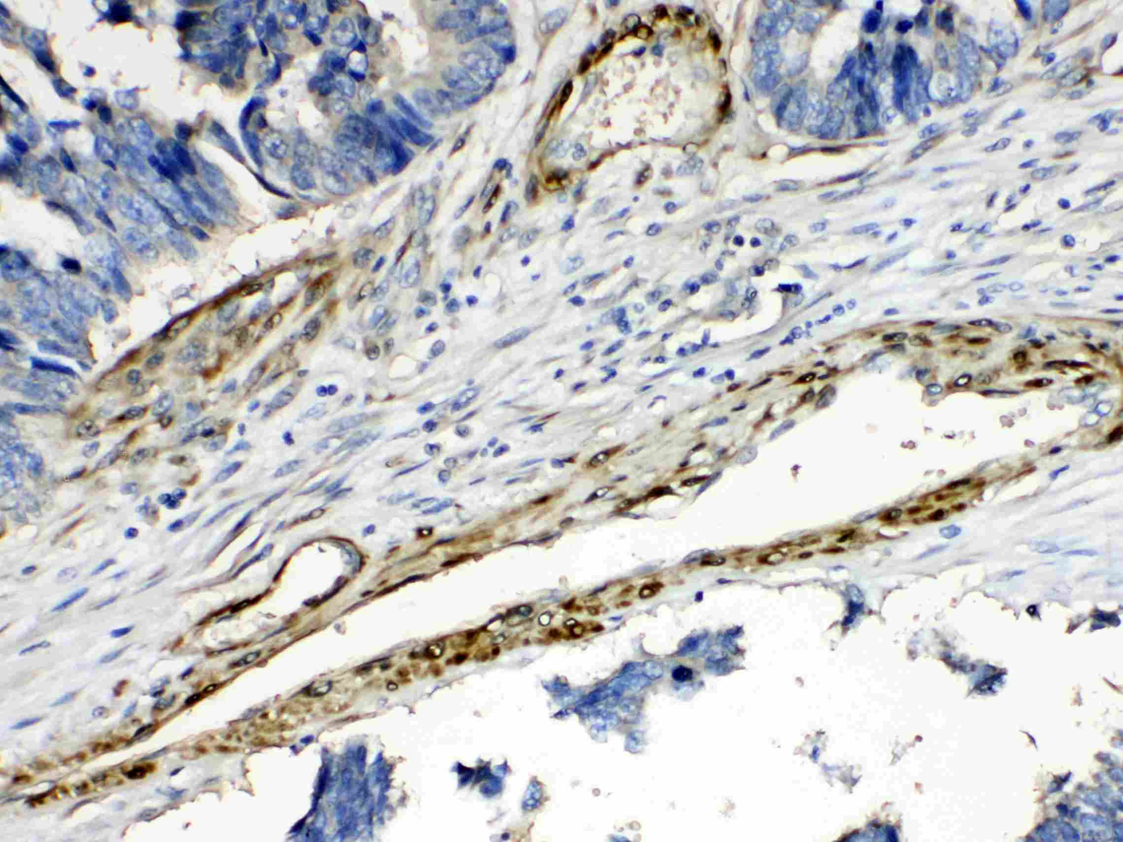 PPP1R14A / CPI-17 Antibody