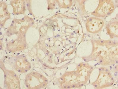 Polyclonal Rabbit anti-Human CCDC108 Antibody (Coiled-coil domain, IHC, WB)