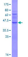 Human RNF122 Protein (Recombinant GST)