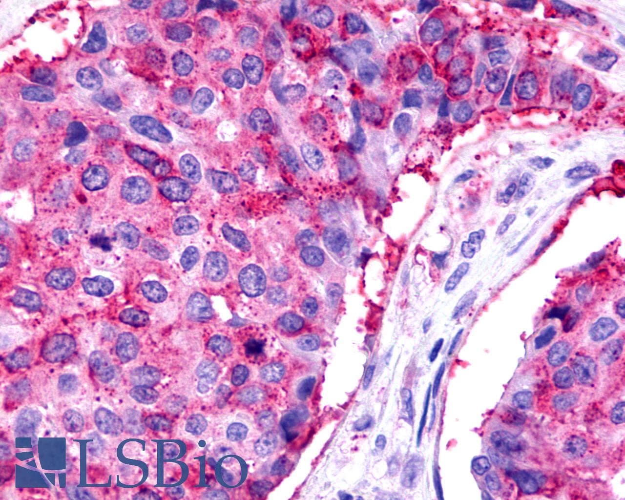 PathPlus™ TPRA1 / GPR175 Antibody (Cytoplasmic Domain)