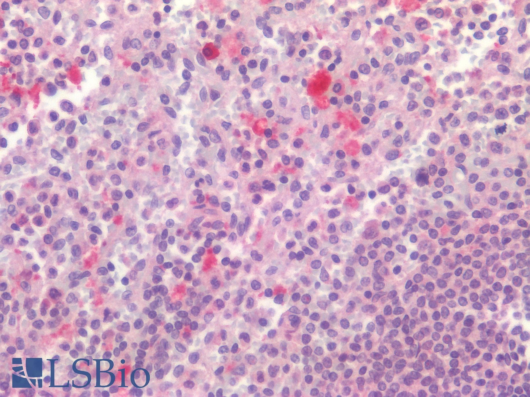 IHC-plus™ CD4 Antibody (Extracellular Domain)