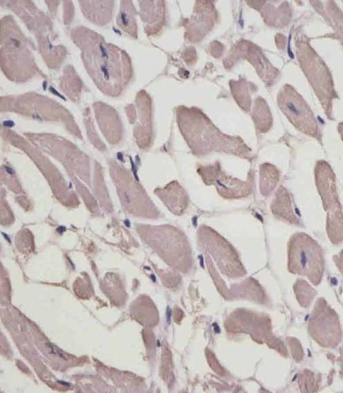 MLC3F / MYL1 Antibody (Internal)