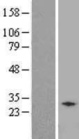 Human RCAN2 / RCN2 Protein (Over-Expression Lysate Myc-DDK (Flag))