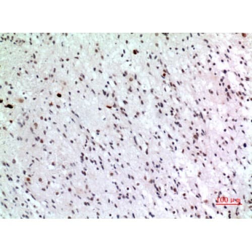 CDKN1C / p57 Kip2 Antibody