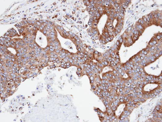 Polyclonal Rabbit anti-Human CPNE3 Antibody (aa234-537, IHC, WB)