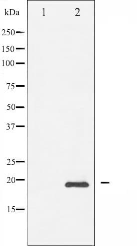 BIRC5 / Survivin Antibody (phospho-Thr117)