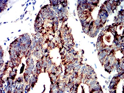 Monoclonal Mouse anti-Human PRKAA2 / AMPK Alpha 2 Antibody (clone 8E11H5, IHC, WB)