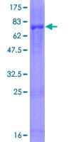 Human CHIT1 / Chitotriosidase Protein (Recombinant GST)