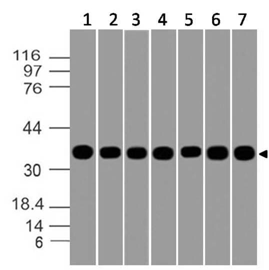 IHC-plus™ Monoclonal Mouse anti-Human GAPDH Antibody (clone ABM22C5, aa120-320, IHC, WB)