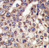 Polyclonal Rabbit anti-Human MTMR4 Antibody (aa1155-1187, IHC, WB)