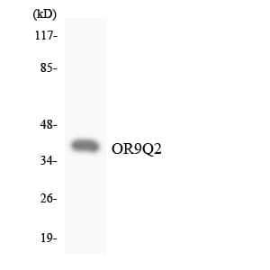 Polyclonal Rabbit anti-Human OR9Q2 Antibody (aa222-271, WB)