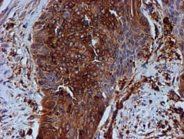 TUBB4 / Tubulin Beta 4 Antibody (clone OTI3F1, Carrier-free)