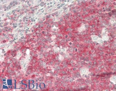 IHC-plus™ KLHL38 Antibody (aa76-104)