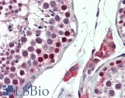 Polyclonal Rabbit anti-Human SSX1 Antibody (C-terminal, IHC, WB)