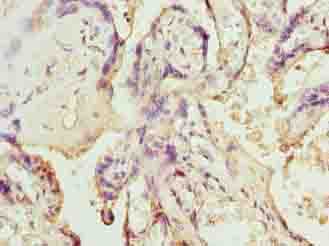 SLC12A4 / KCC1 Antibody