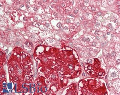 IHC-plus™ USP13 Antibody (aa175-225)