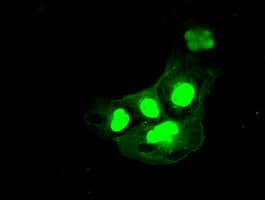 DFFA / ICAD / DFF45 Antibody (clone OTI3F12)