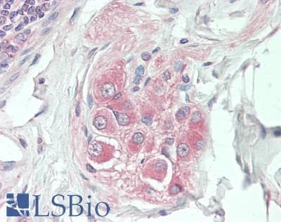 IHC-plus™ Polyclonal Rabbit anti-Human ITSN2 Antibody (aa550-600, IHC, WB)