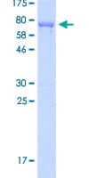 Human C11orf16 Protein (Recombinant GST)