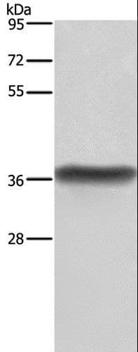HSD17 / HSD17B1 Antibody