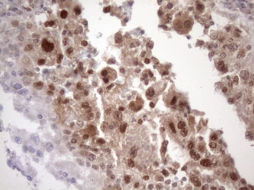 TDG / Thymine DNA Glycosylase Antibody (aa160-253, clone OTI3A12)