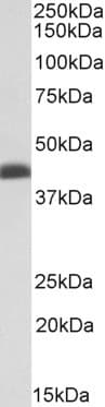 IHC-plus™ BMI1 / PCGF4 Antibody (aa303-315)