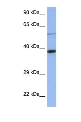 CELF1 / CUGBP1 Antibody (aa120-169)