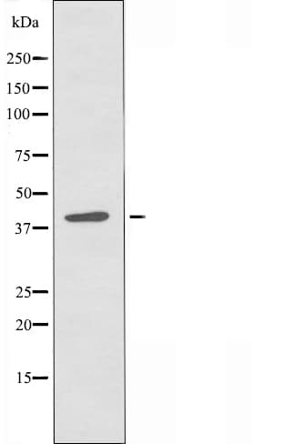 Polyclonal Rabbit anti-Human GALNAC4ST1 / CHST8 Antibody (IF, WB)