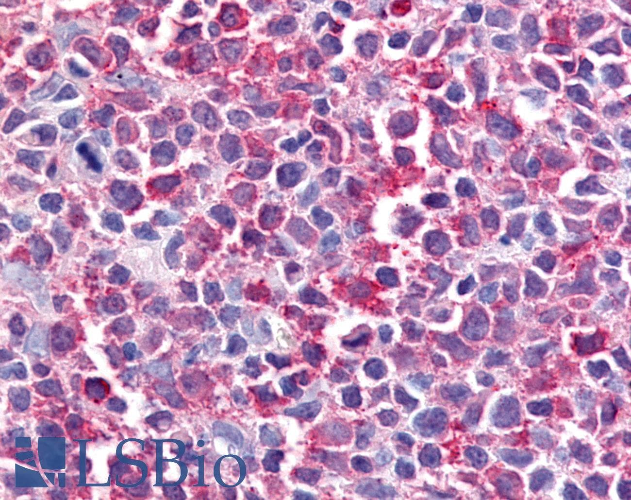 IHC-plus™ BEST2 / Bestrophin-2 Antibody (Internal)
